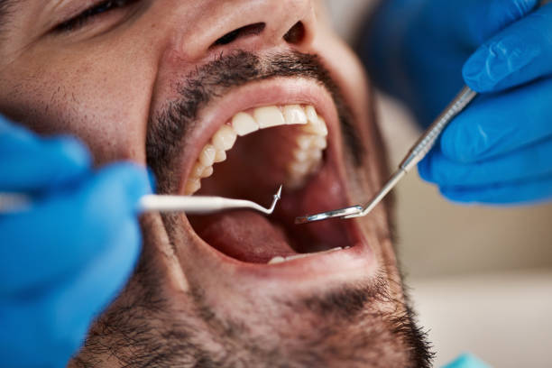 Best Urgent Care for Lost Fillings or Crowns in Georgetown, TX